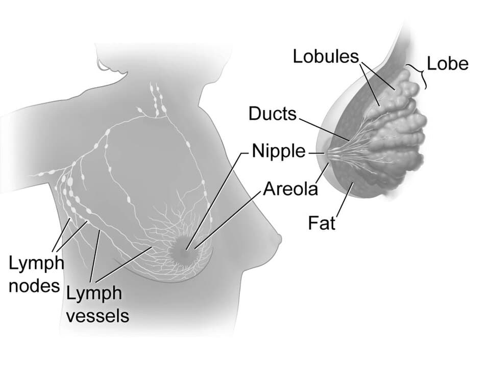 Medical illustration of breast anatomy showing the ducts, lobules, and tissue where cancers most often develop