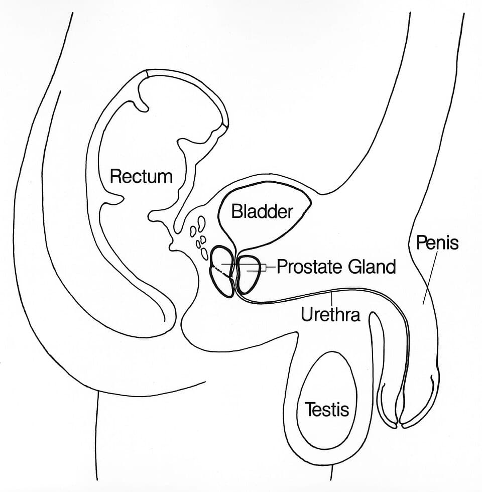 Medical illustration of the prostate gland positioned below the bladder, where prostate cancer develops
